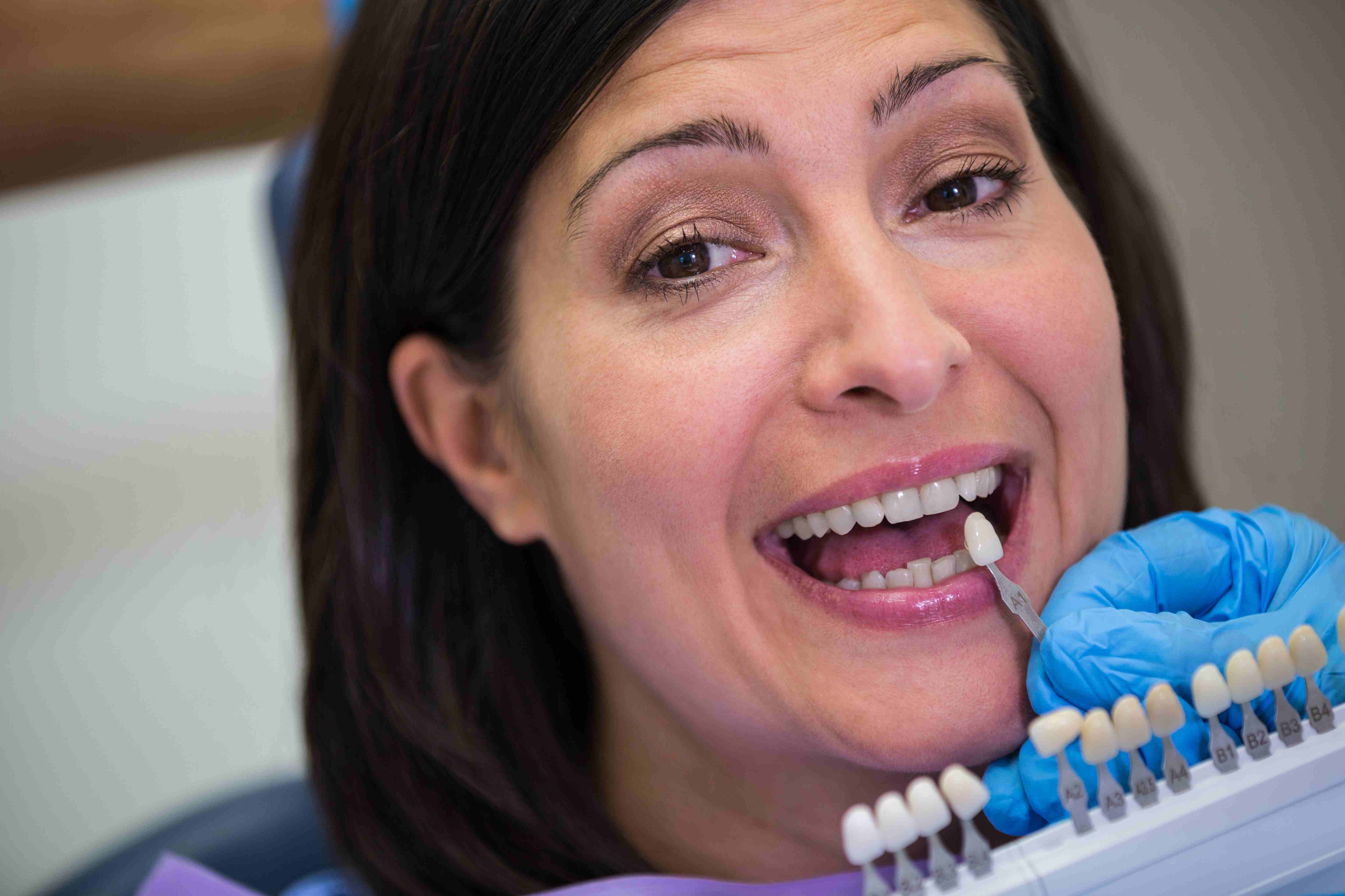 What to Expect During the Dental Implant Process