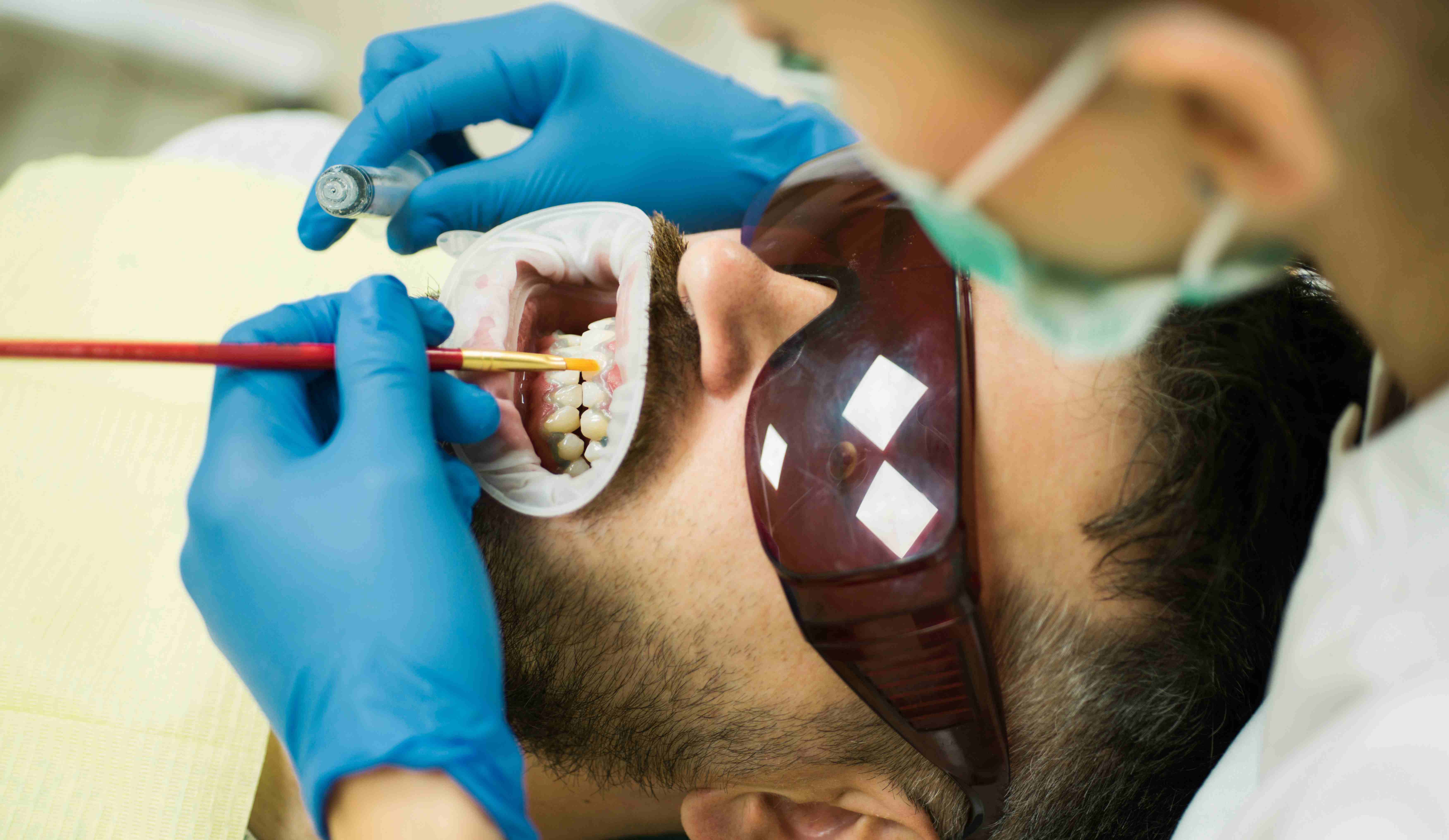 Who Needs Filling & Restorative Dentistry?