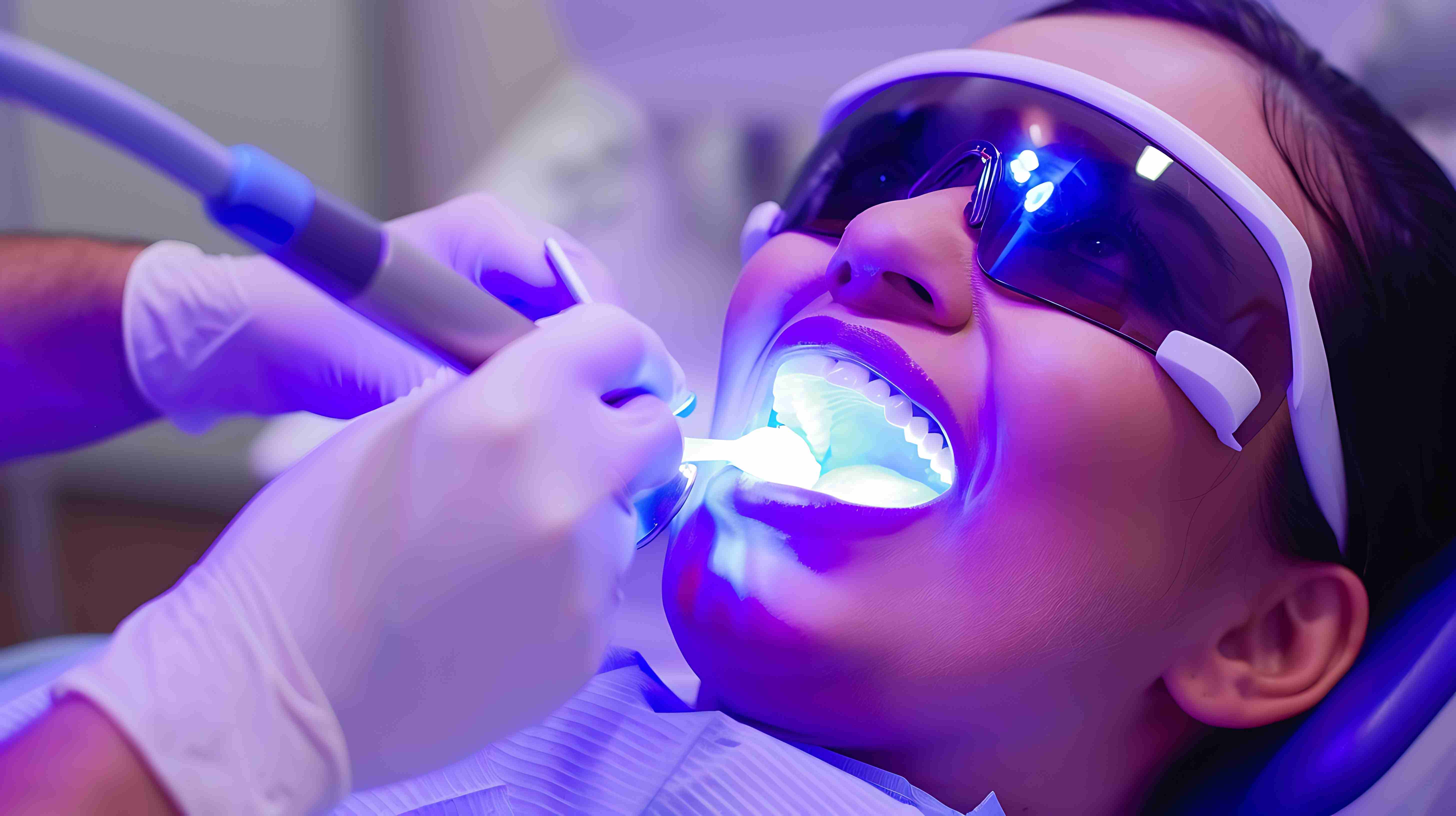 What is Laser Whitening?