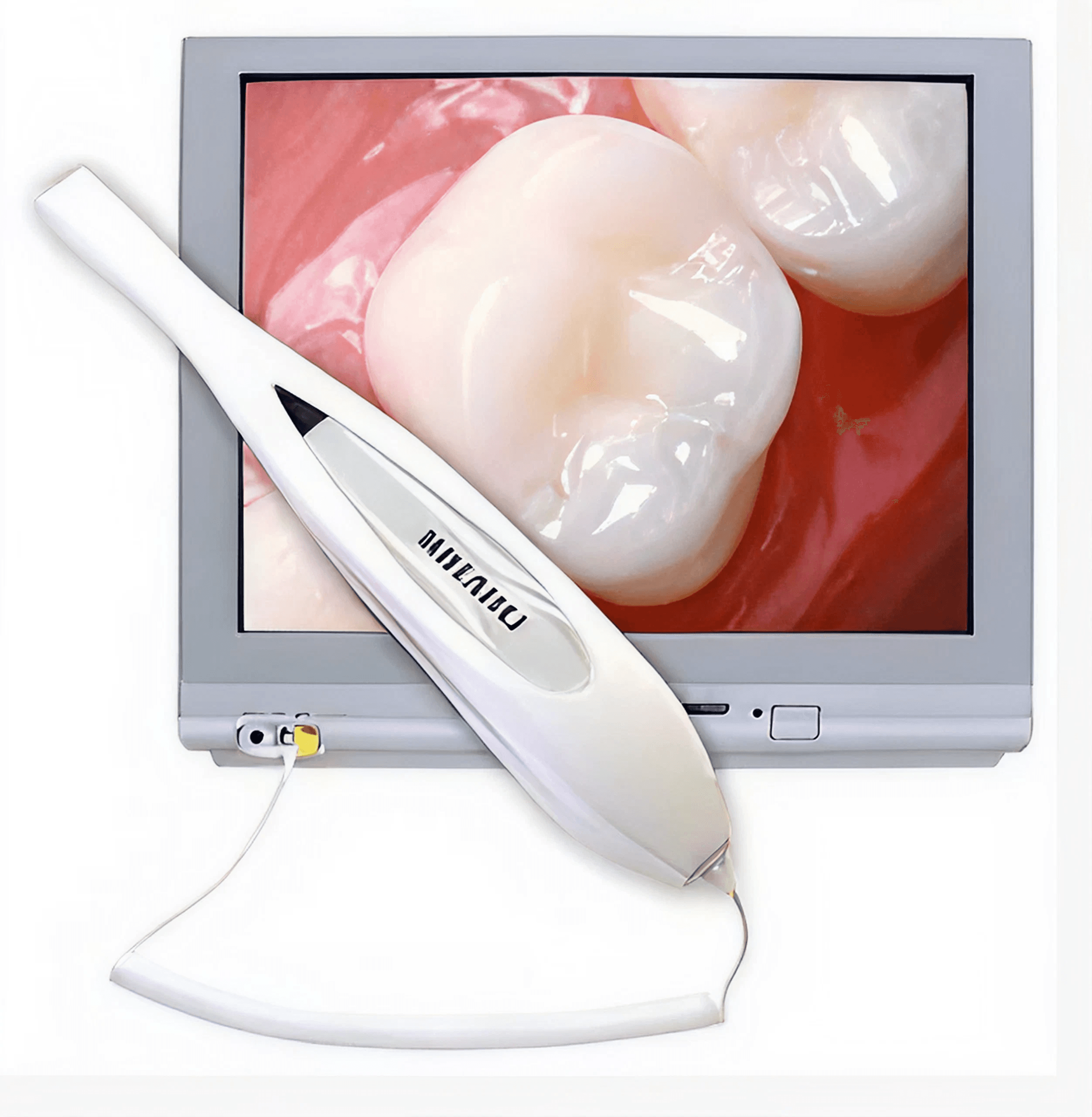 Dentist reviewing intraoral images with a patient