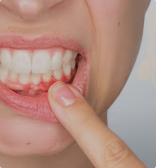 Gum disease examination