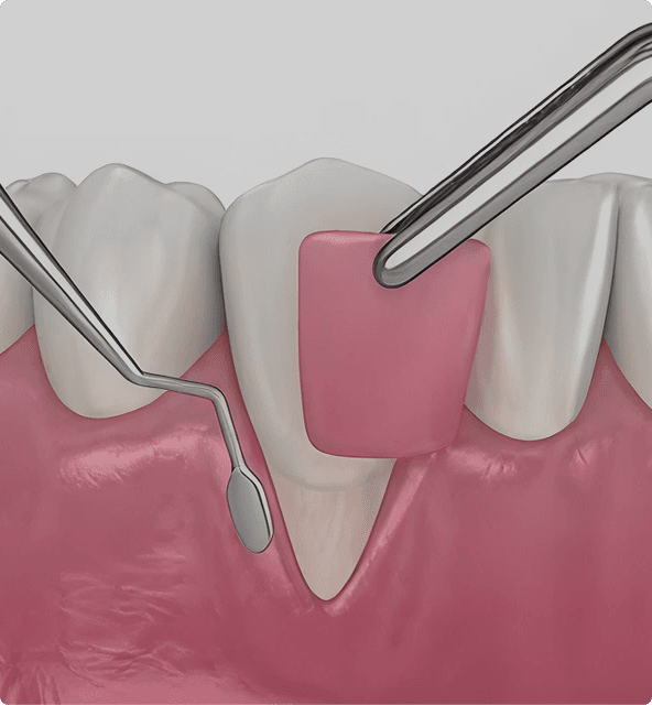 Gum treatment benefits