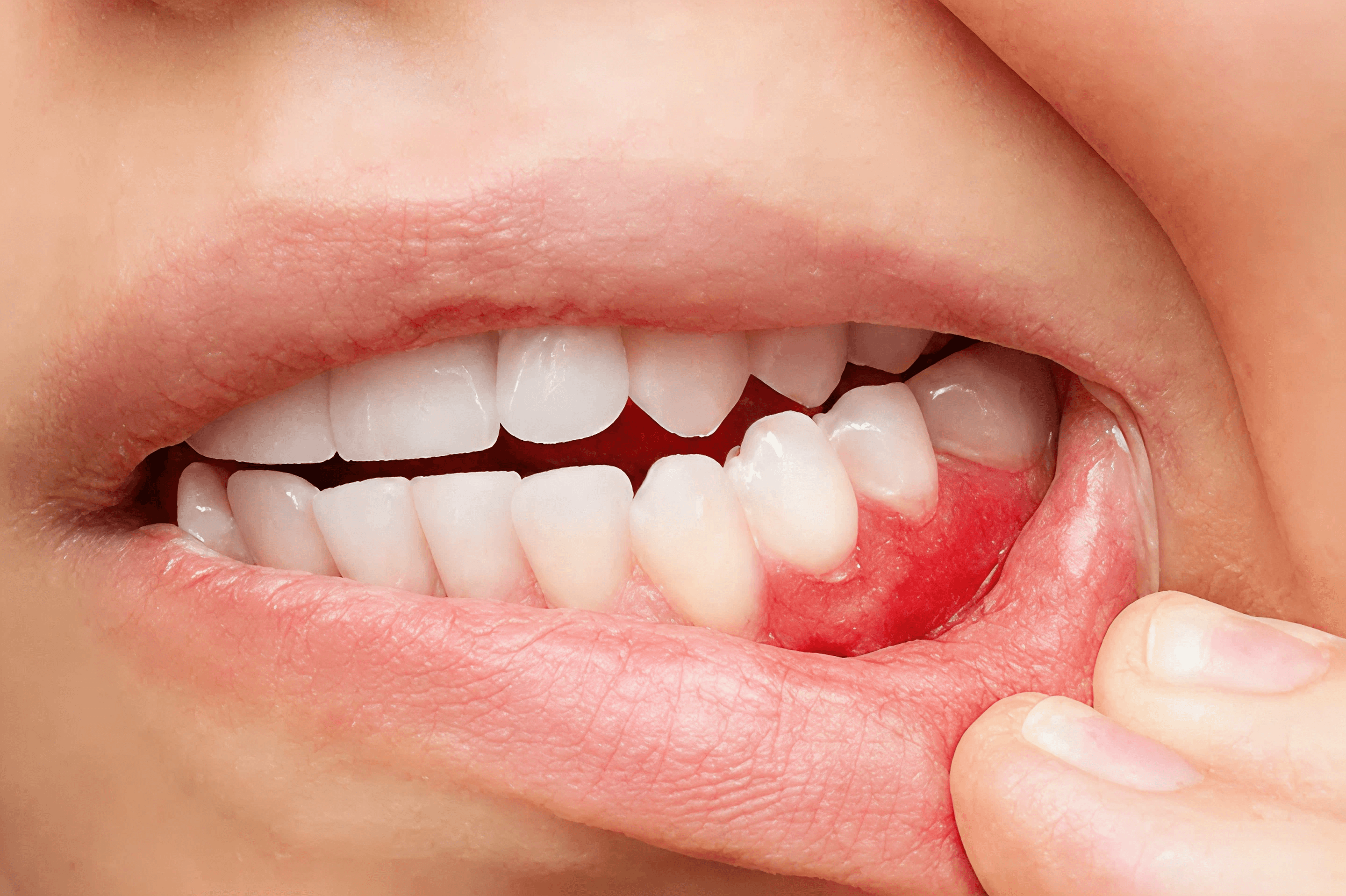 Renew Dental Clinic by Dr. Suchi Singh for best dental care