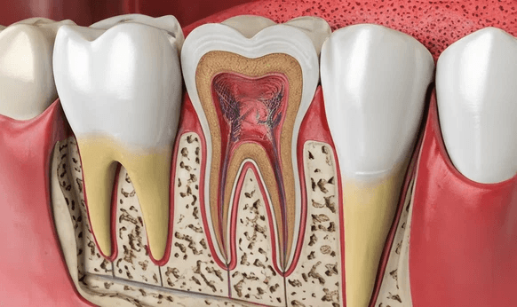 Pediatric dental care