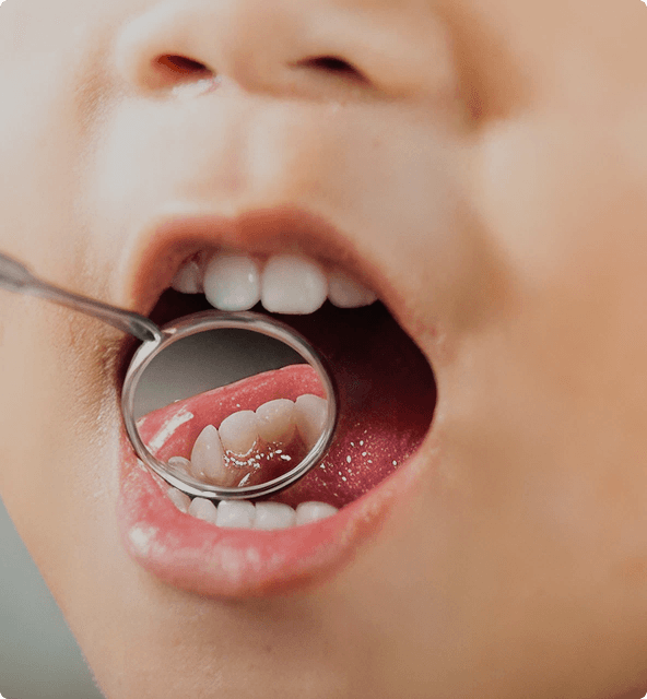 Kids RCT benefits