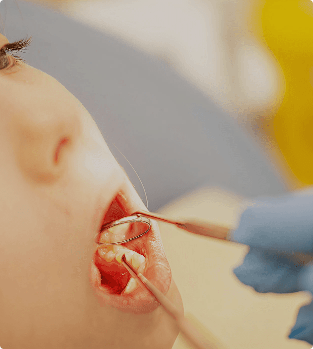 Kids root canal procedure