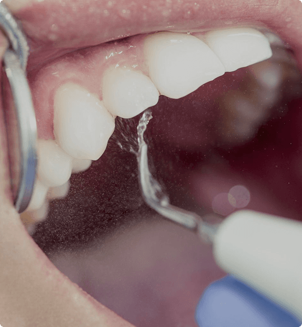 Gum health examination