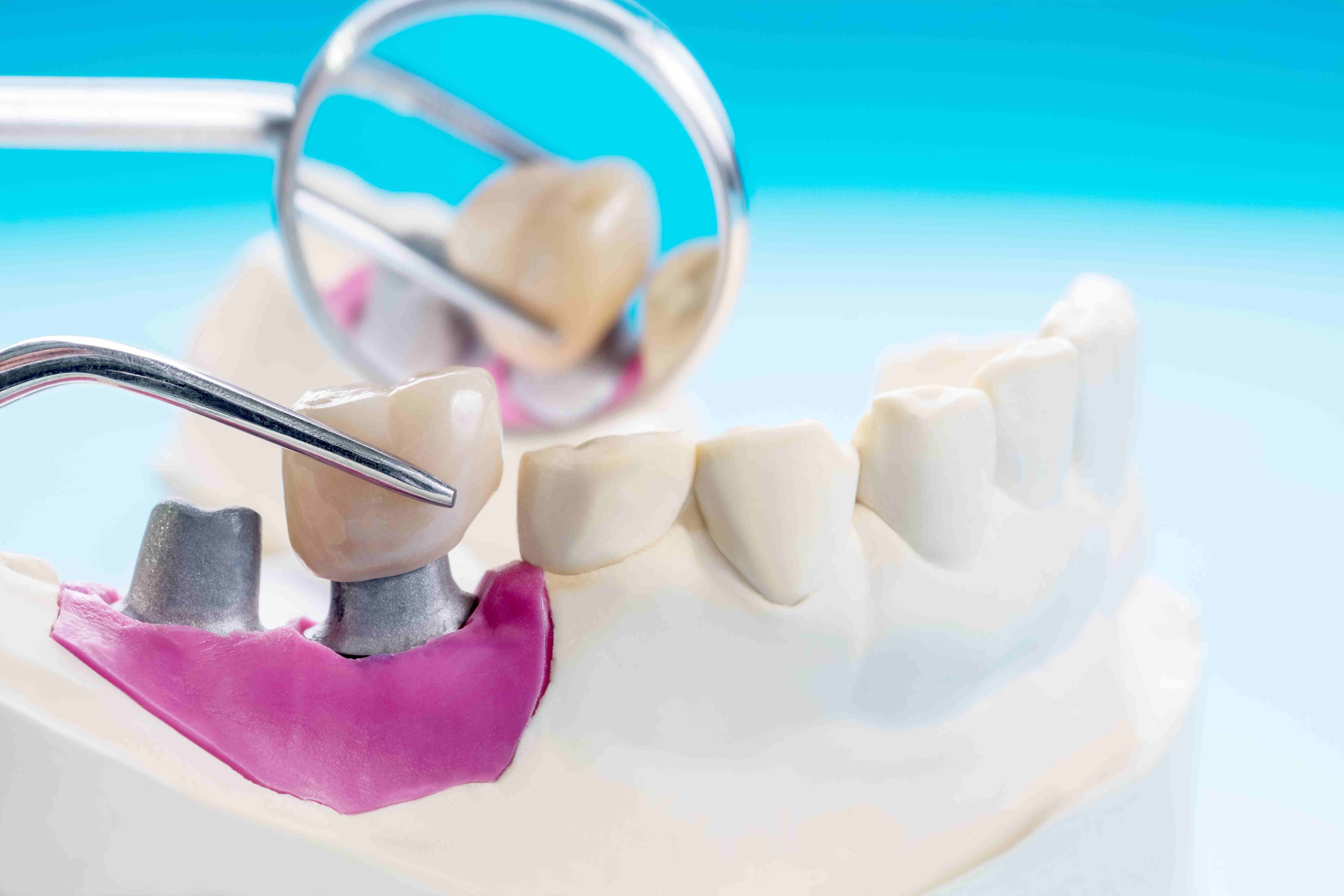 What to Expect During the Procedure