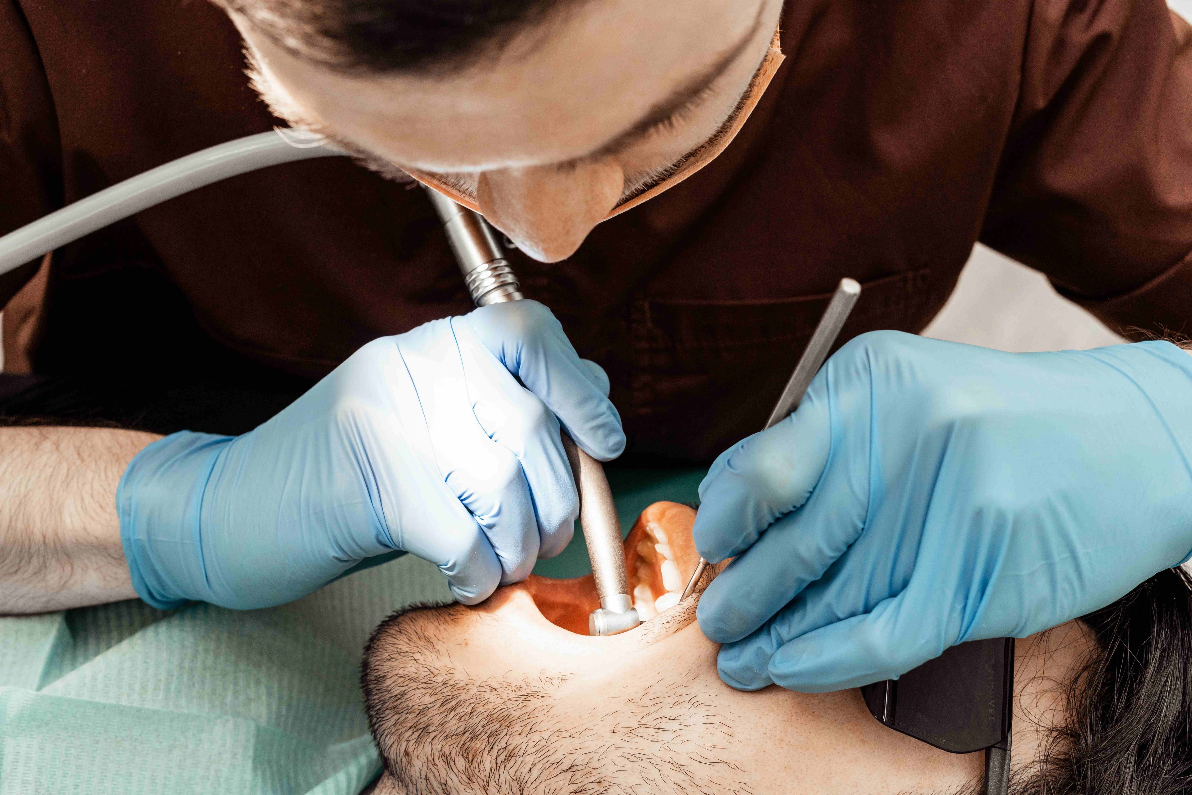 Benefits of Root Canal Treatment