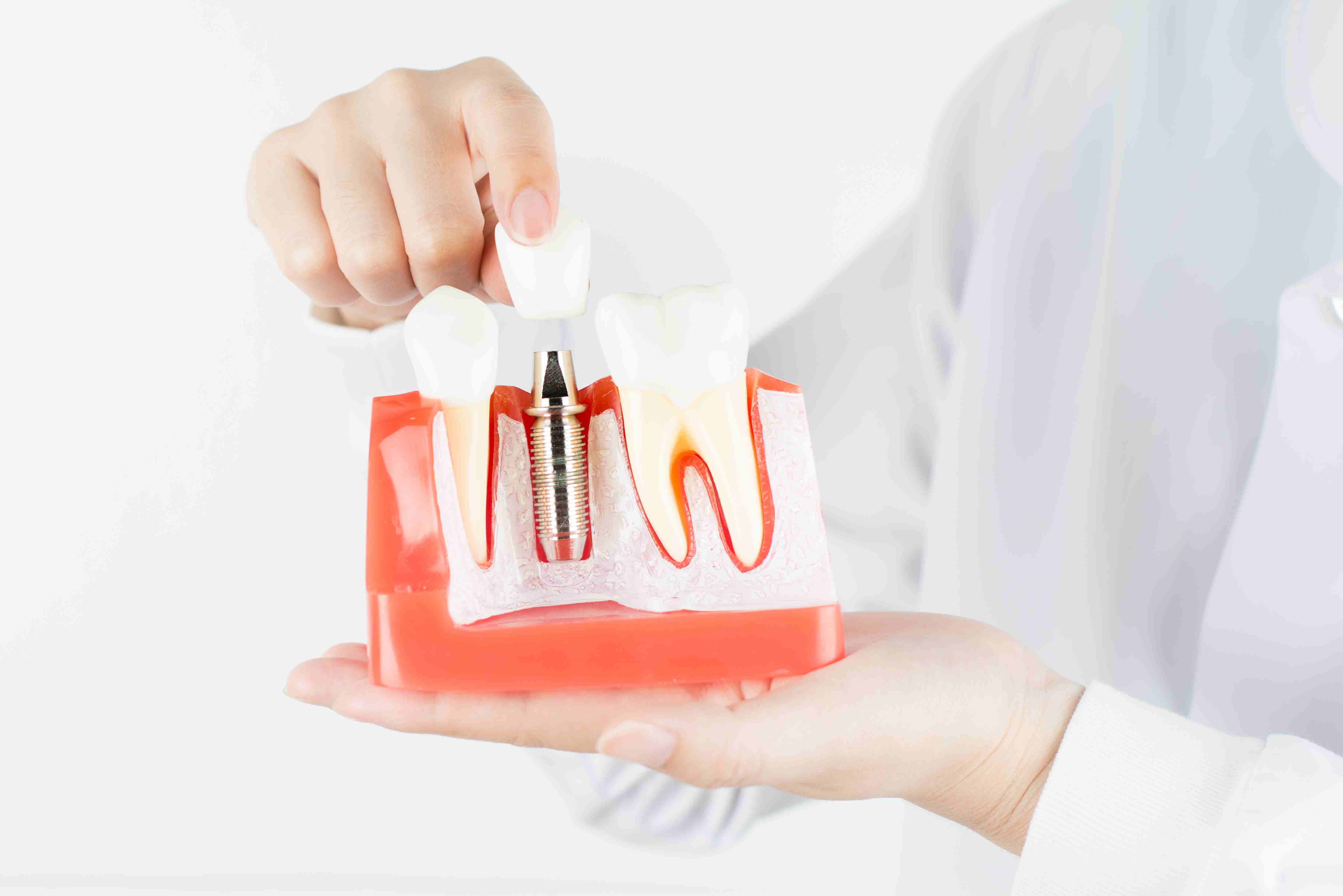 Common root canal treatment Procedures