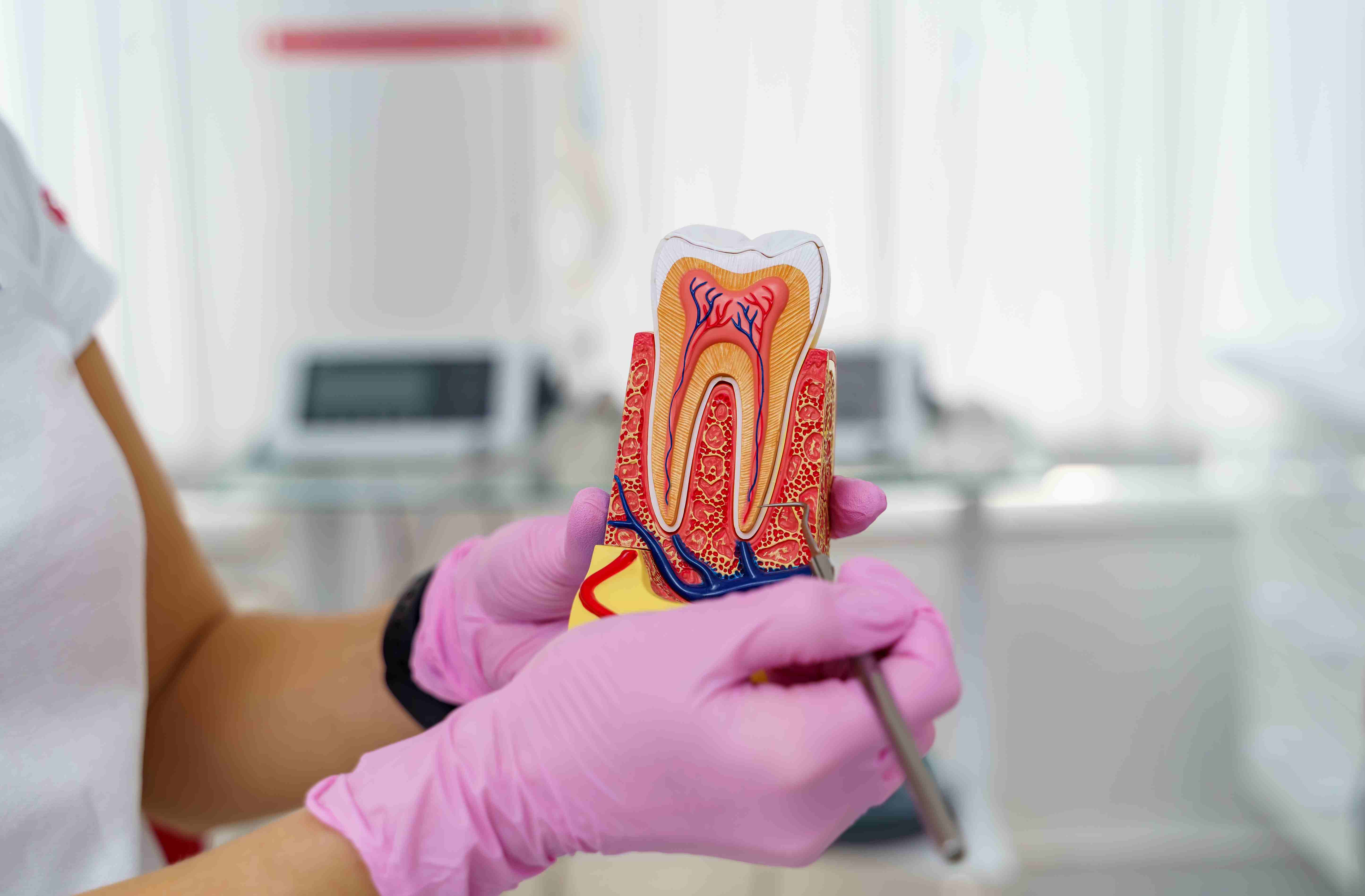 The Root Canal Procedure Step-by-Step