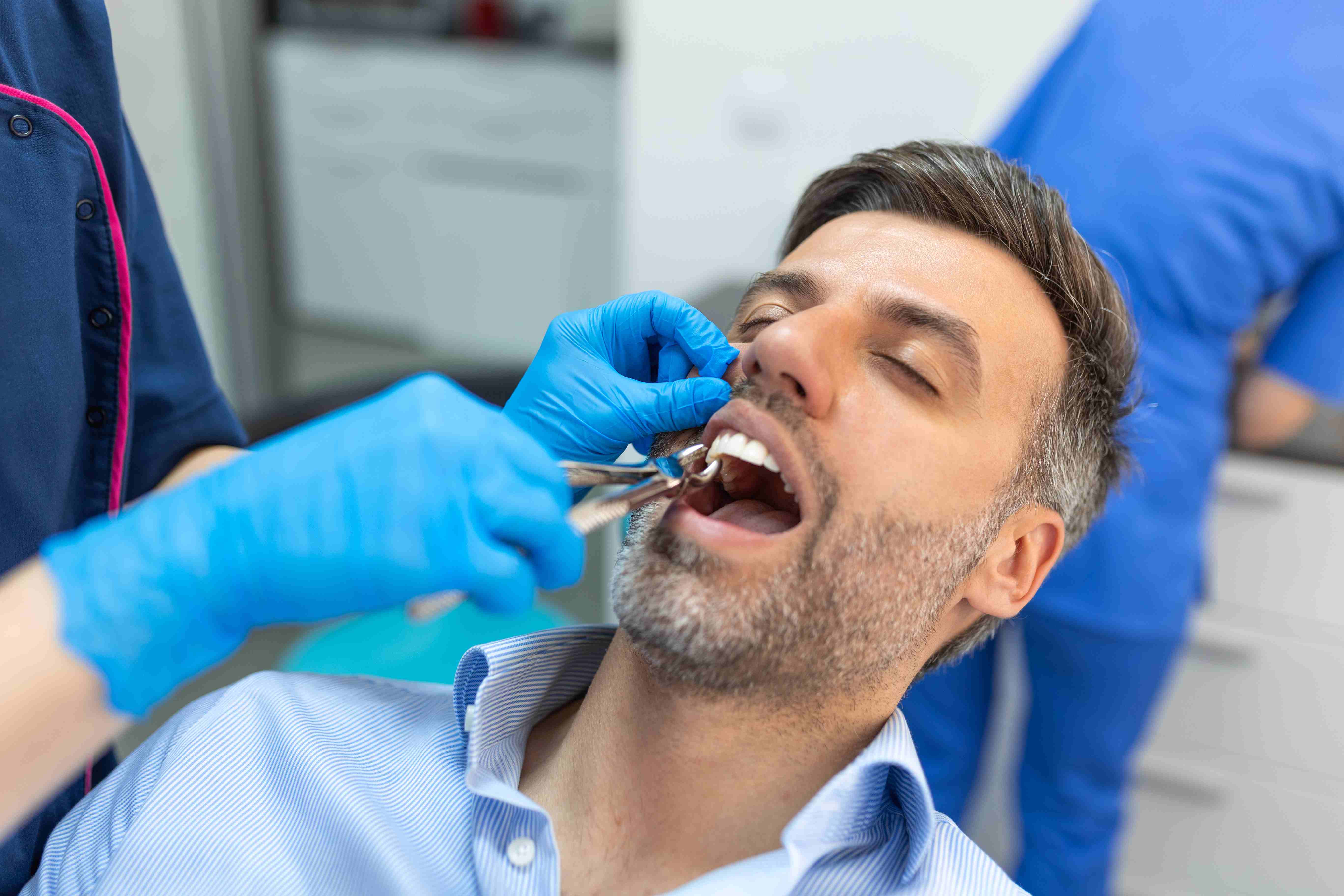 What Is Tooth Extraction
