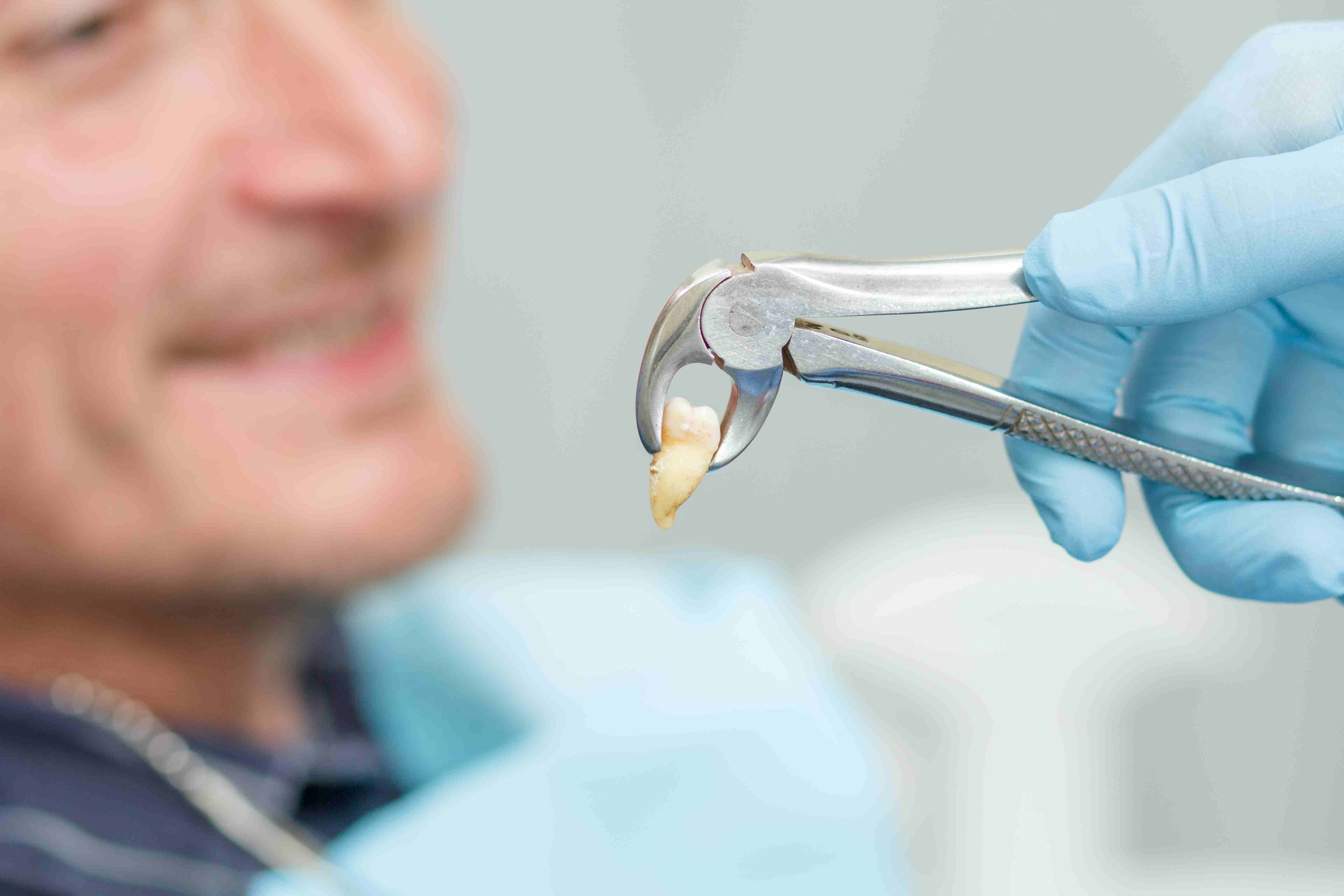 Who Needs Tooth Extraction?