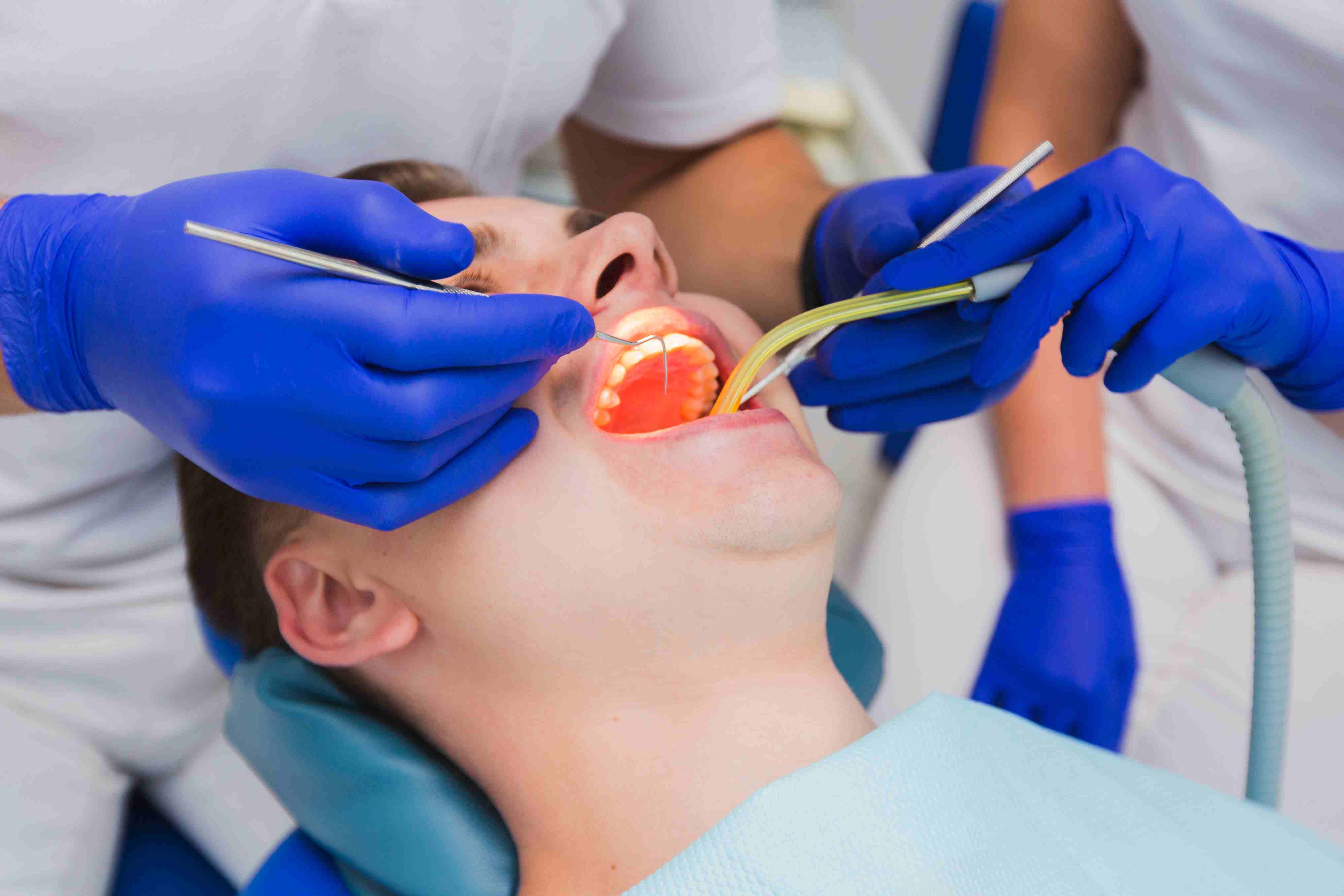 What to Expect During the Tooth Extraction Process