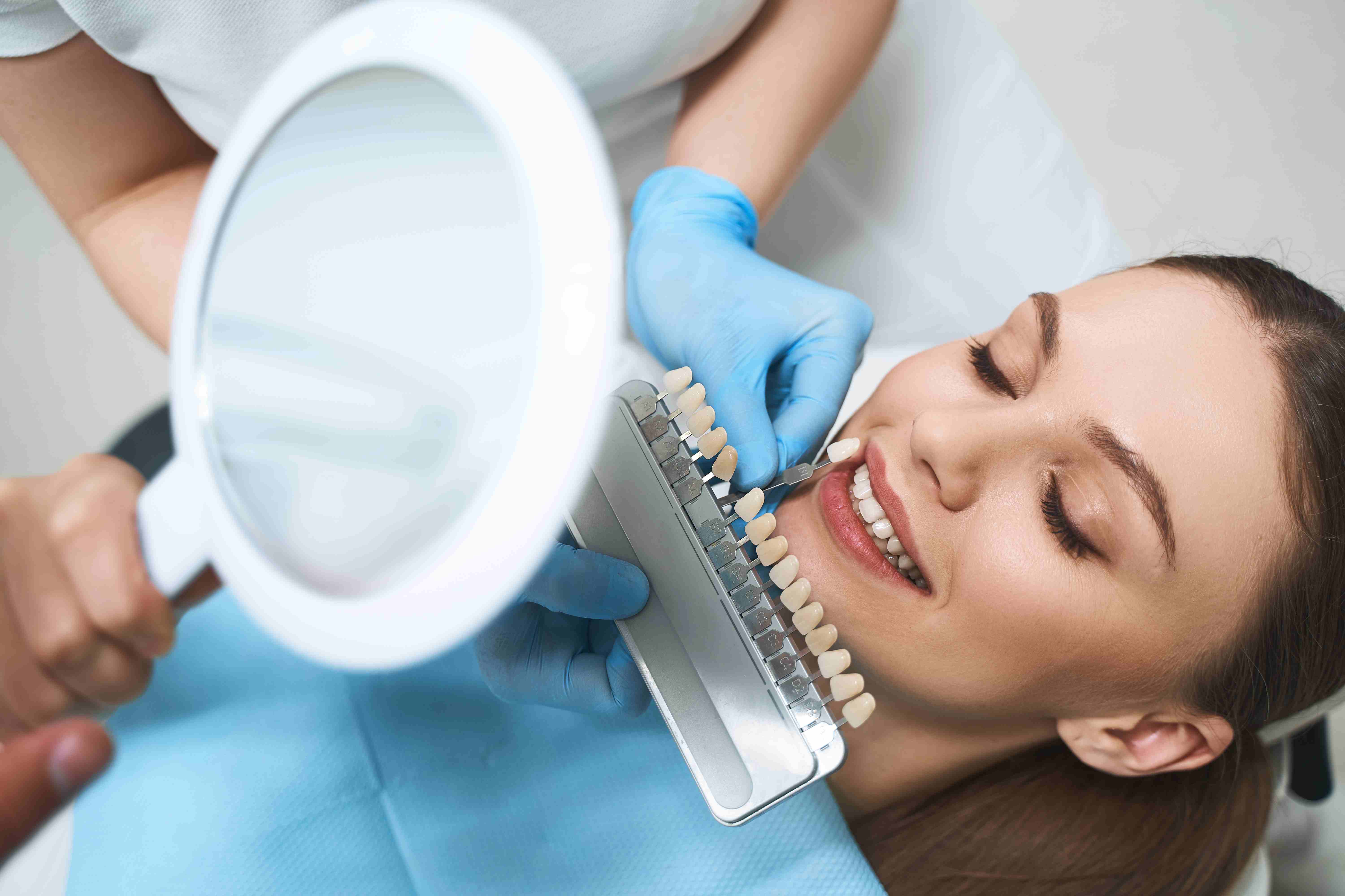 Common Issues Veneers Can Address