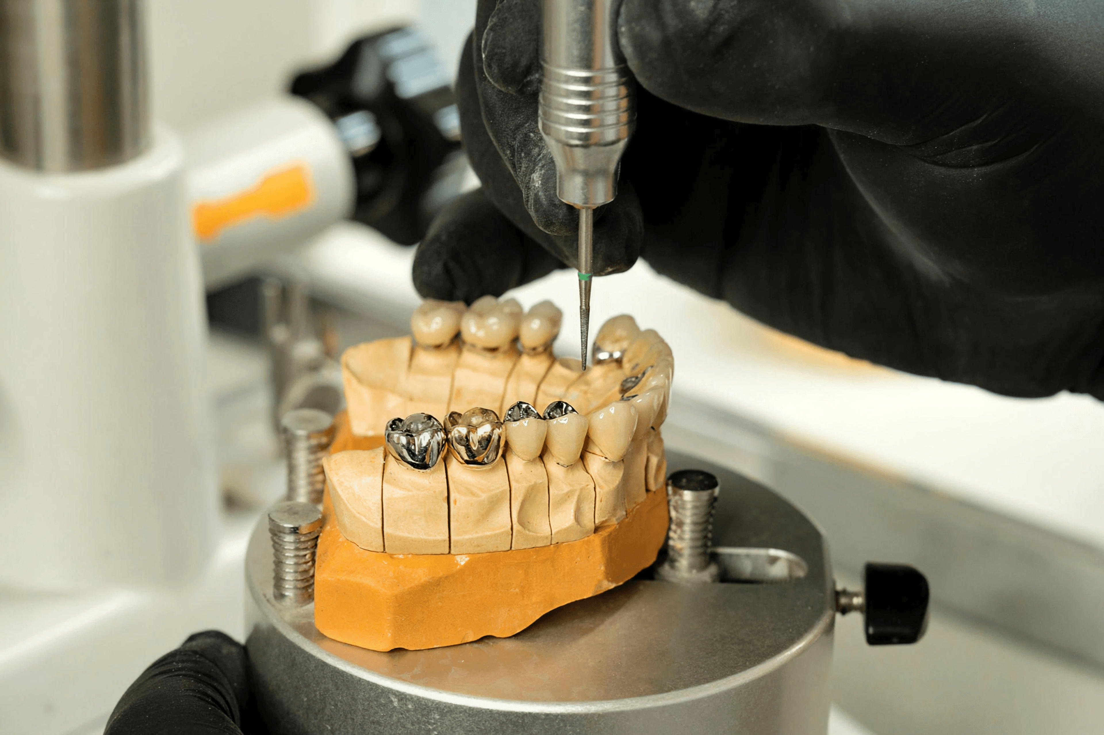 Renew Dental Clinic by Dr. Suchi Singh for best dental care
