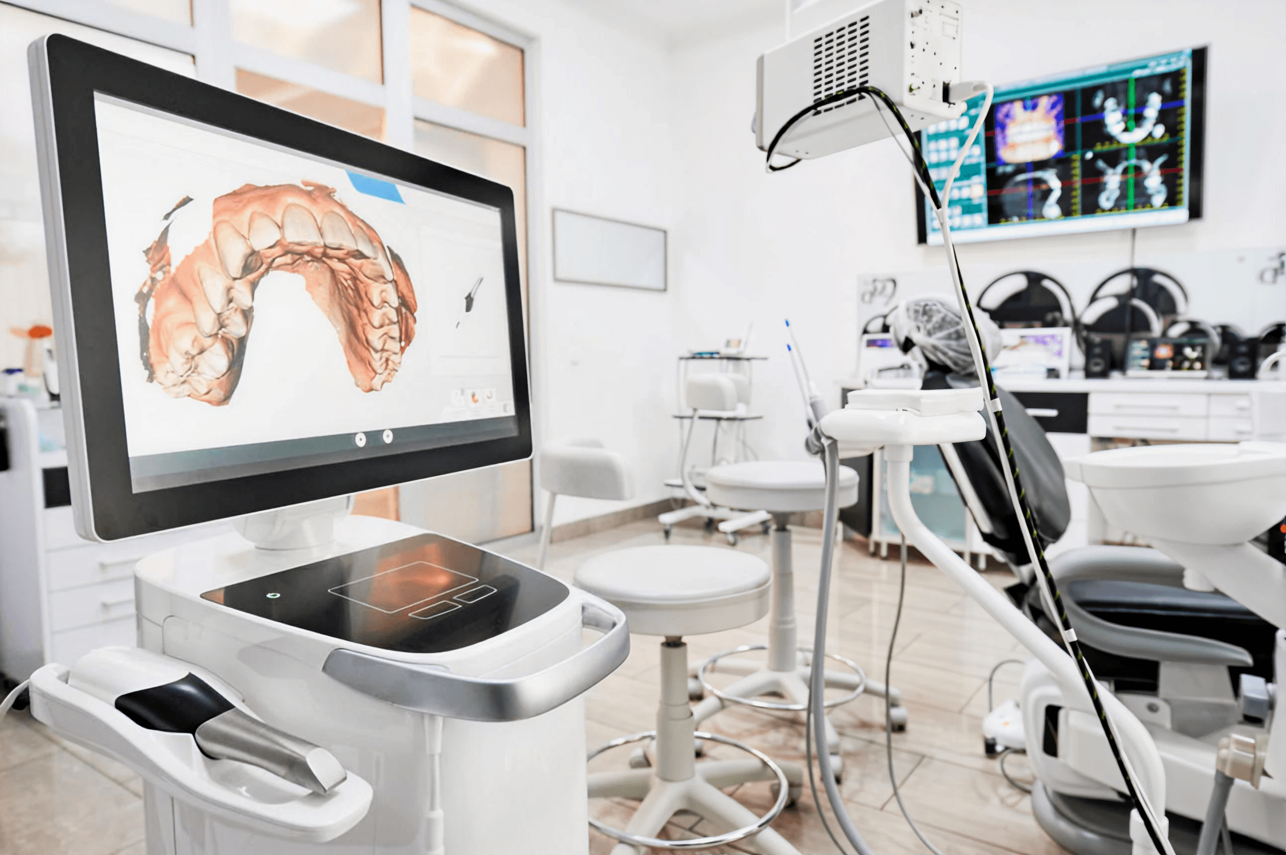 Milled dental restoration