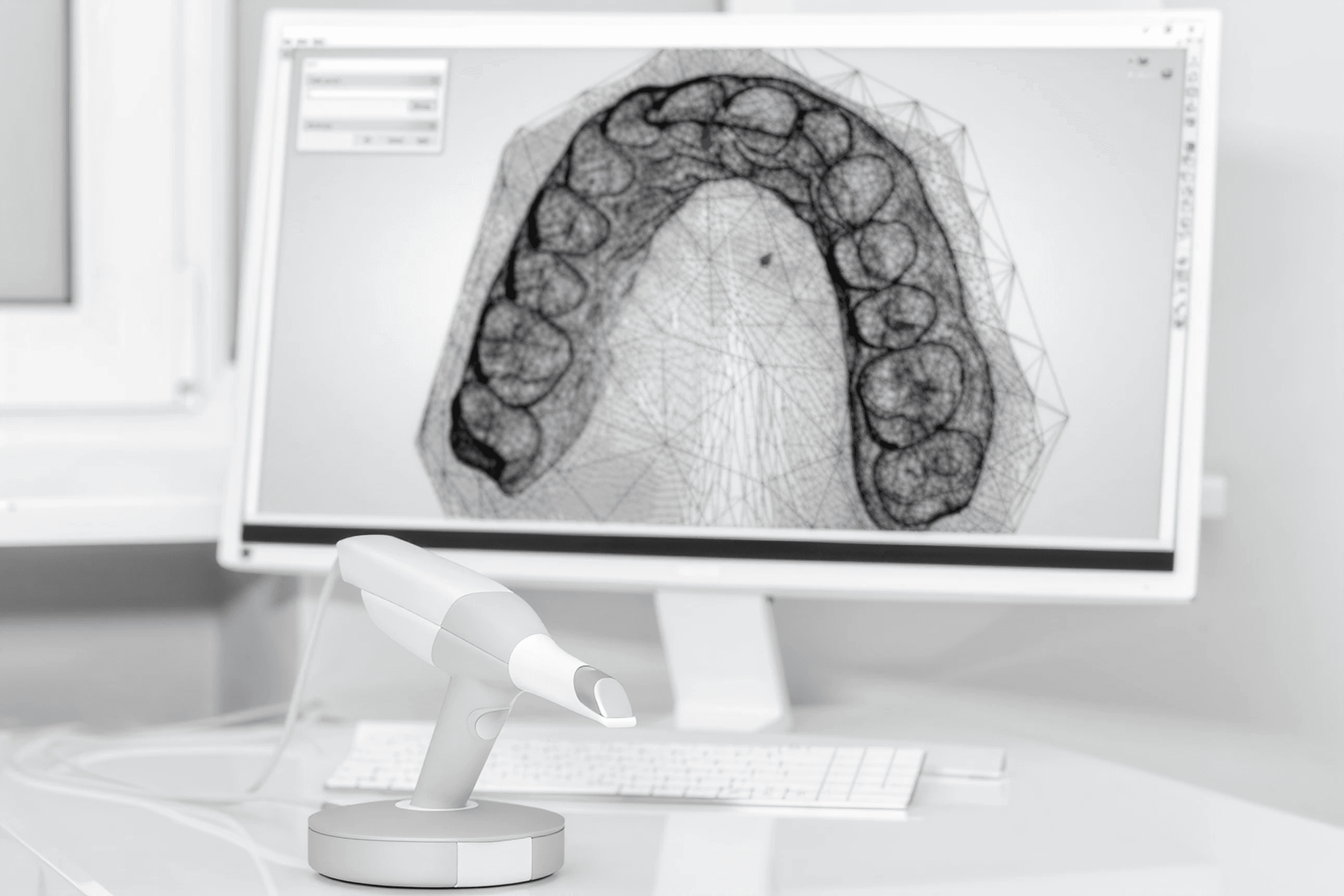 Patient during an intraoral scan