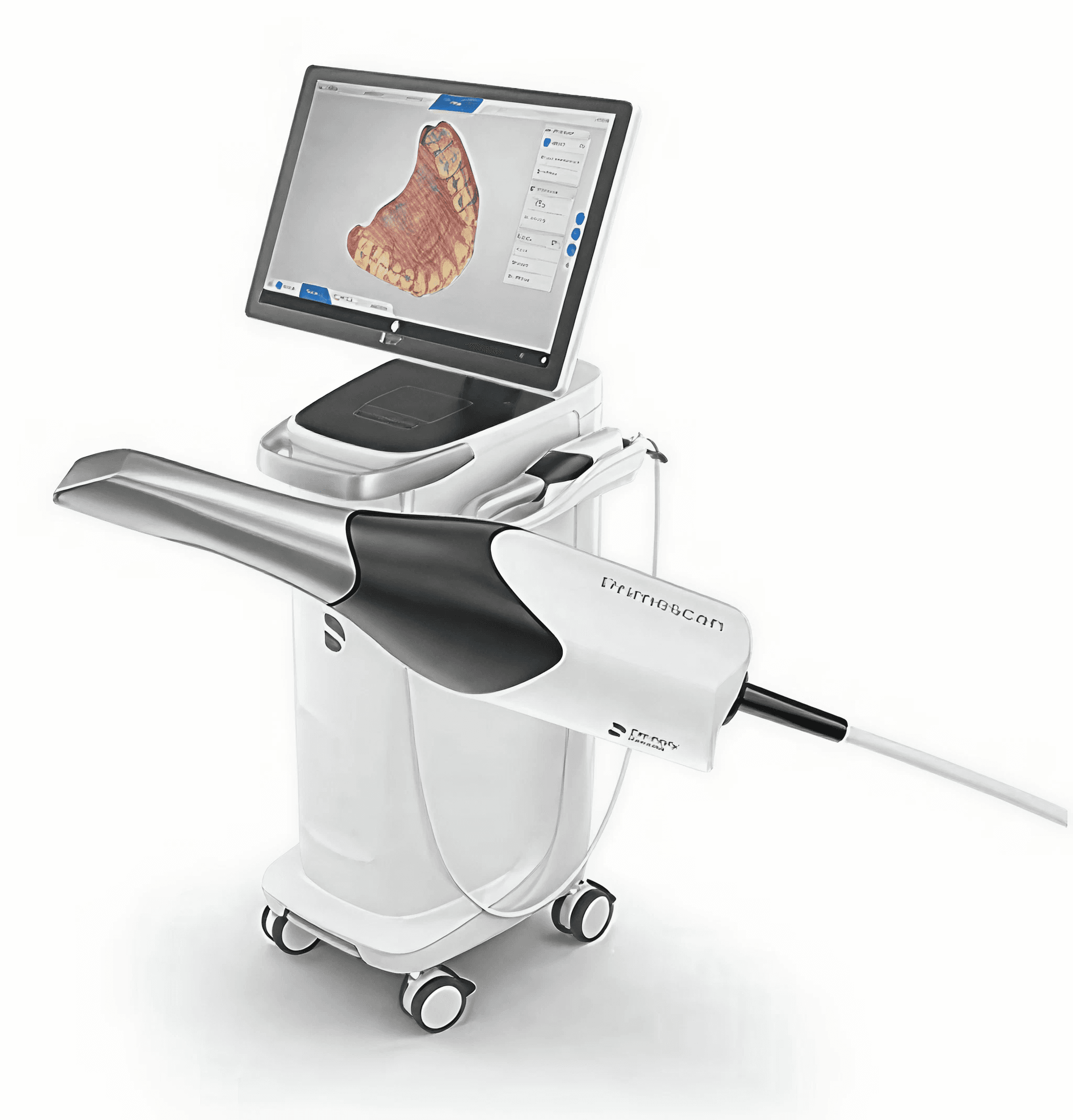 3D digital dental impression on screen
