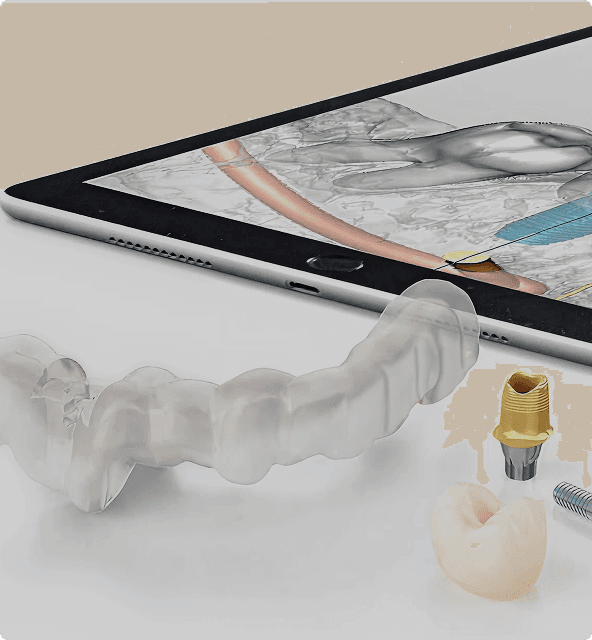 Cortical implant benefits