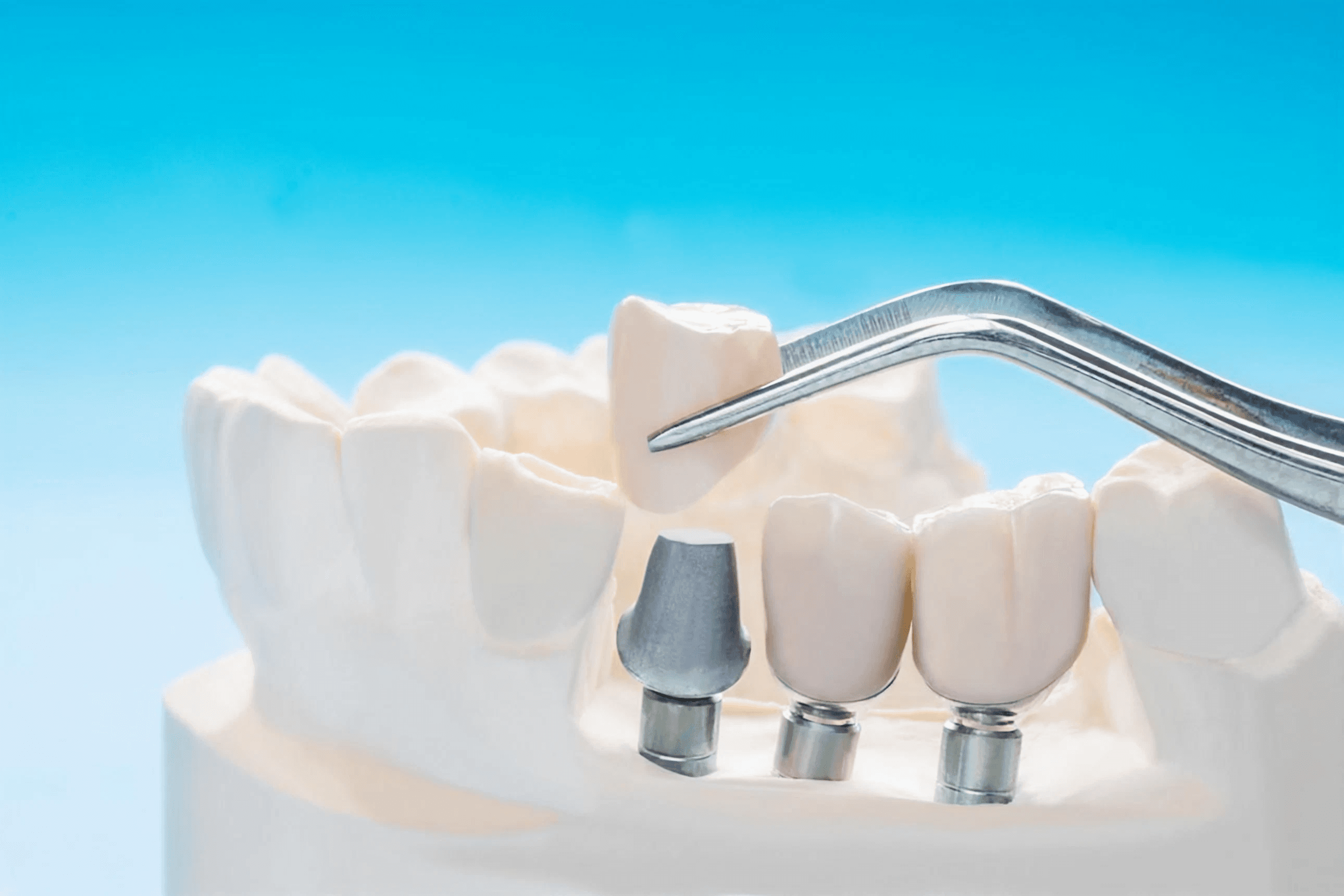Renew Dental Clinic by Dr. Suchi Singh for best dental care