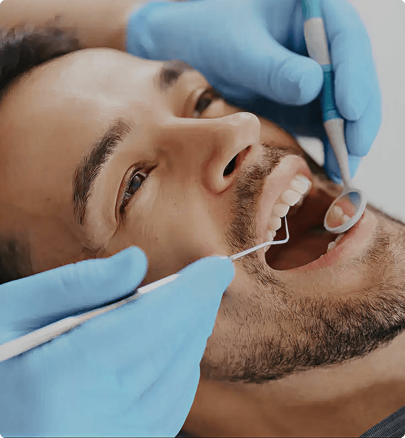 Dental filling benefits