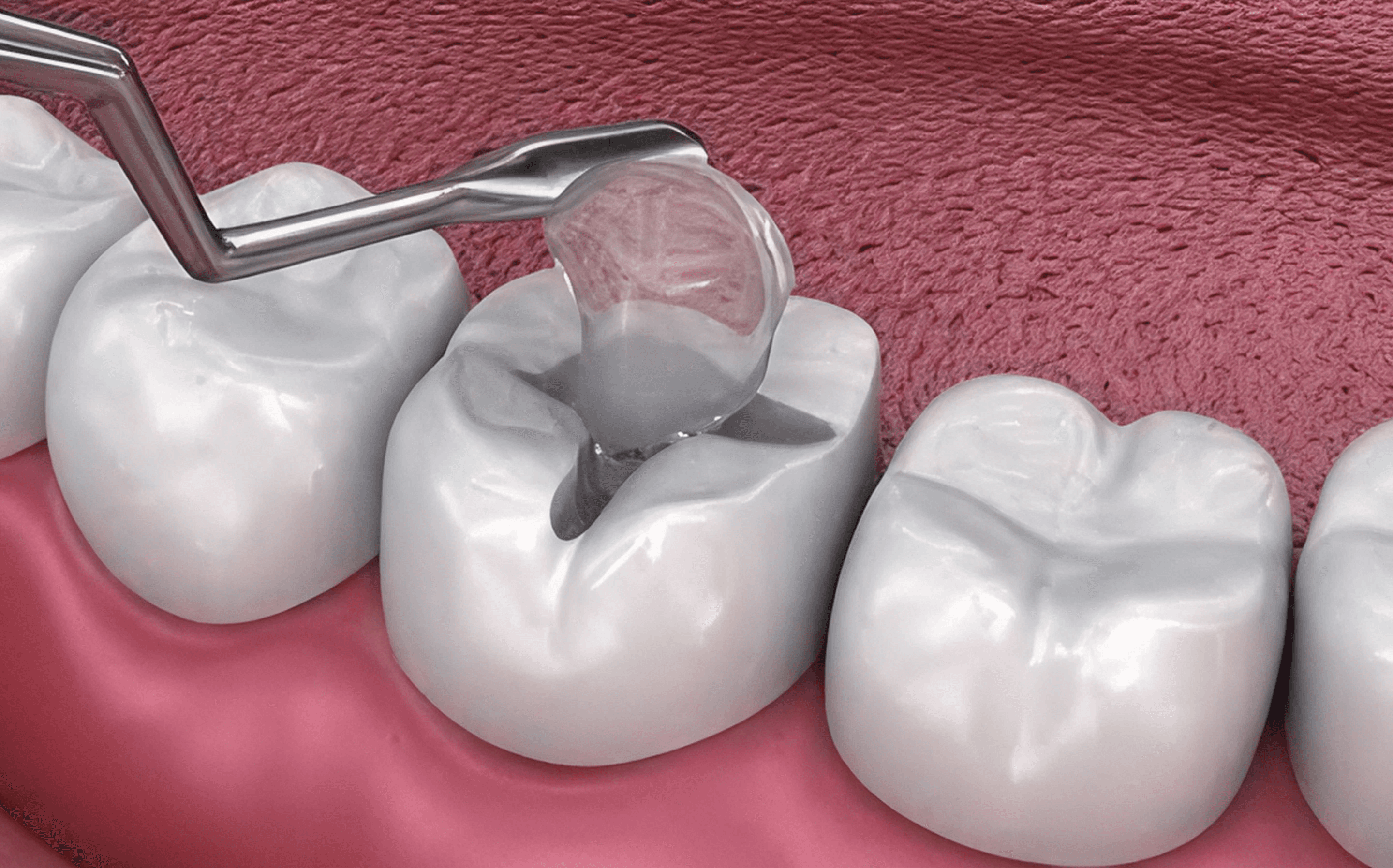 Renew Dental Clinic by Dr. Suchi Singh for best dental care