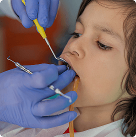 Immediate implant crown