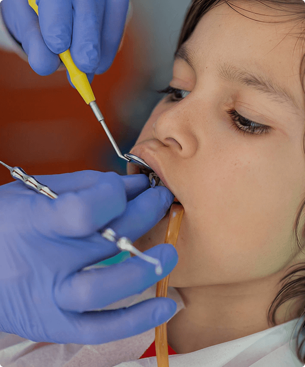 Immediate implant procedure