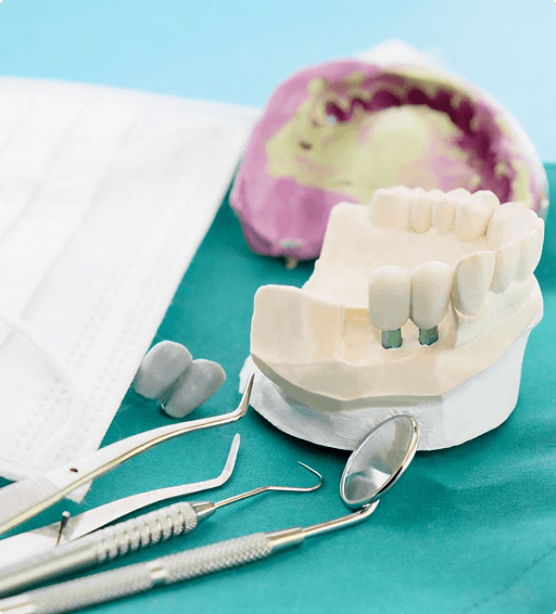 Dental implant