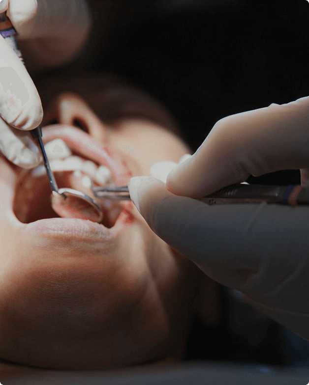 Implant dentistry procedure