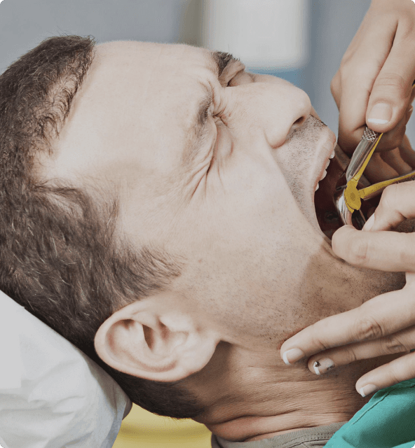 Wisdom tooth examination