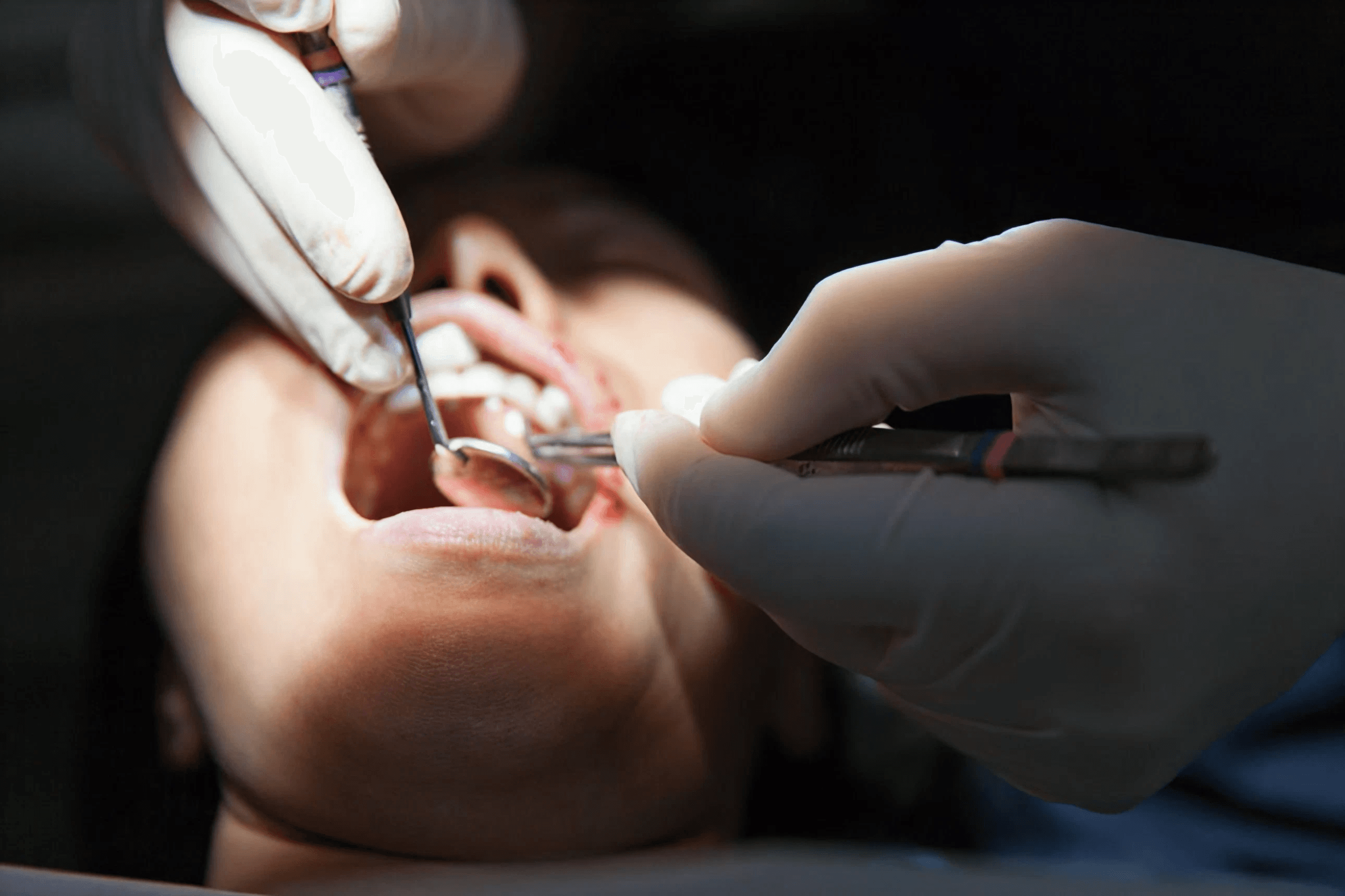 Renew Dental Clinic by Dr. Suchi Singh for best dental care
