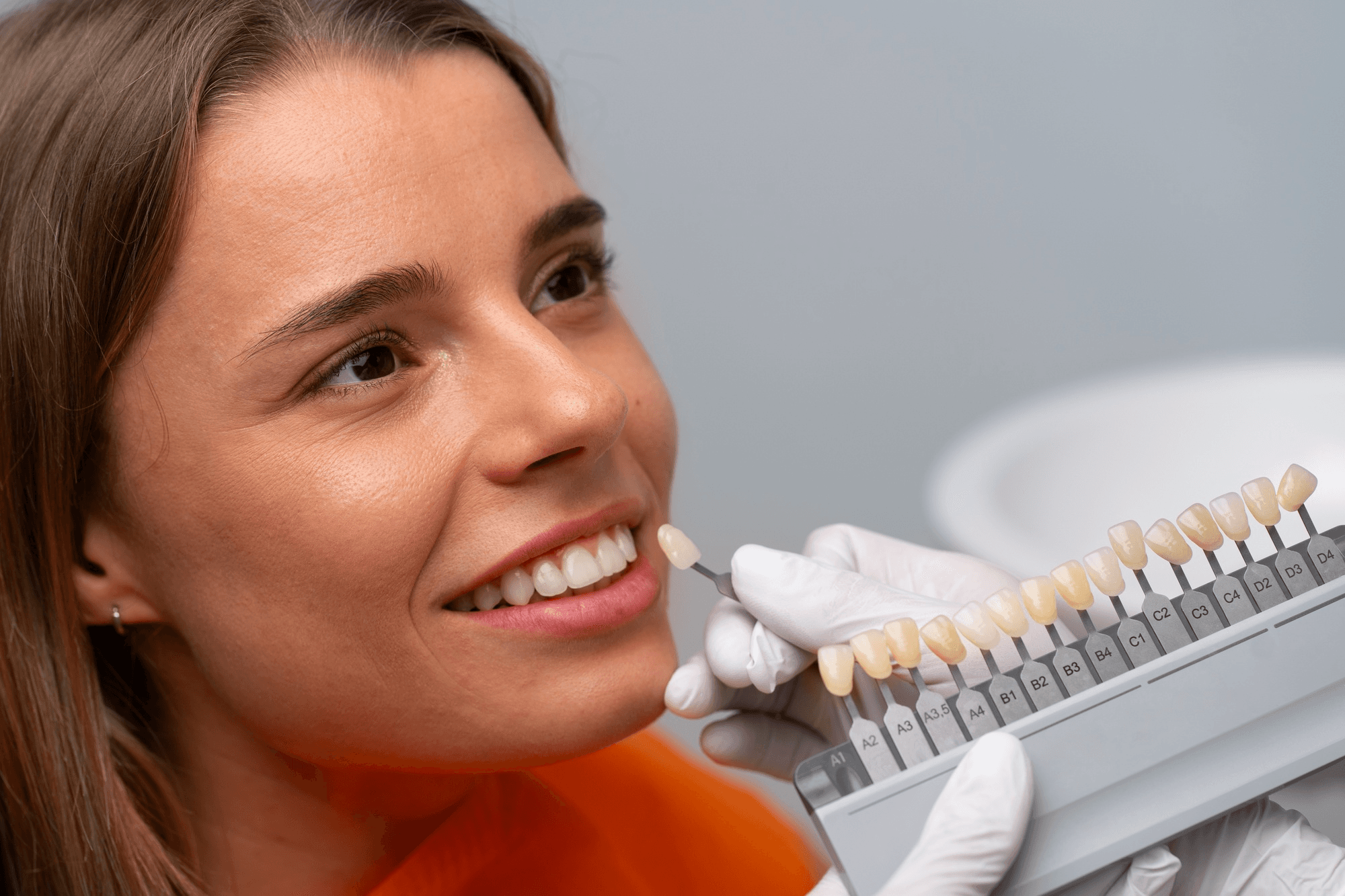 Dental crown shade matching procedure.