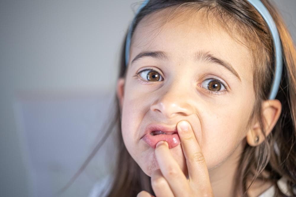 A young girl with long hair and a headband is grimacing while touching her mouth, indicating discomfort, possibly an ulcer. Her eyes are wide with concern.