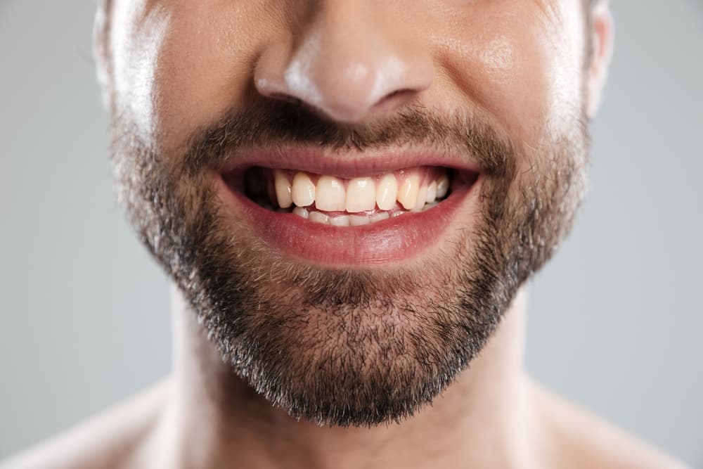 Laughing man's face.